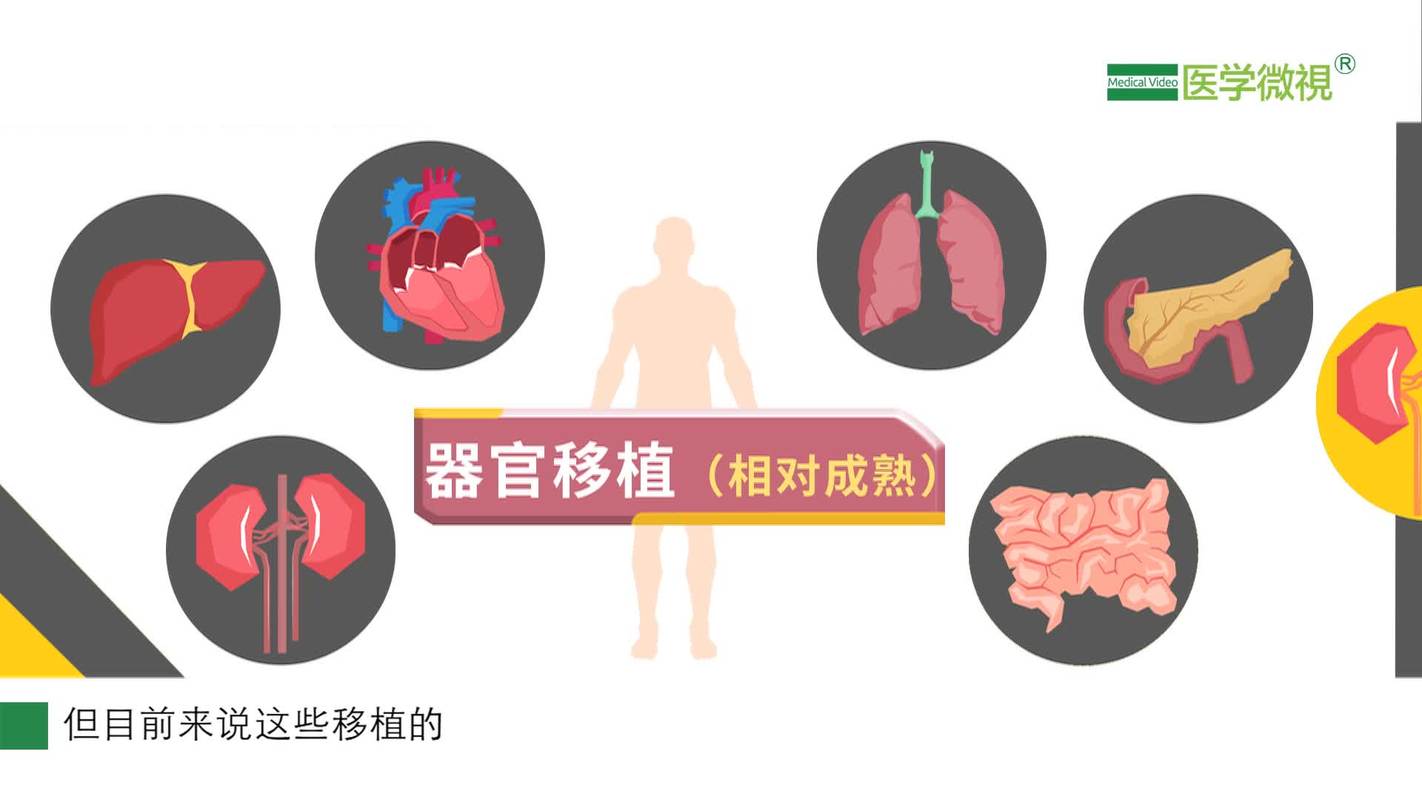 人的肉可移植吗？（人体哪些器官可以移植）-图2