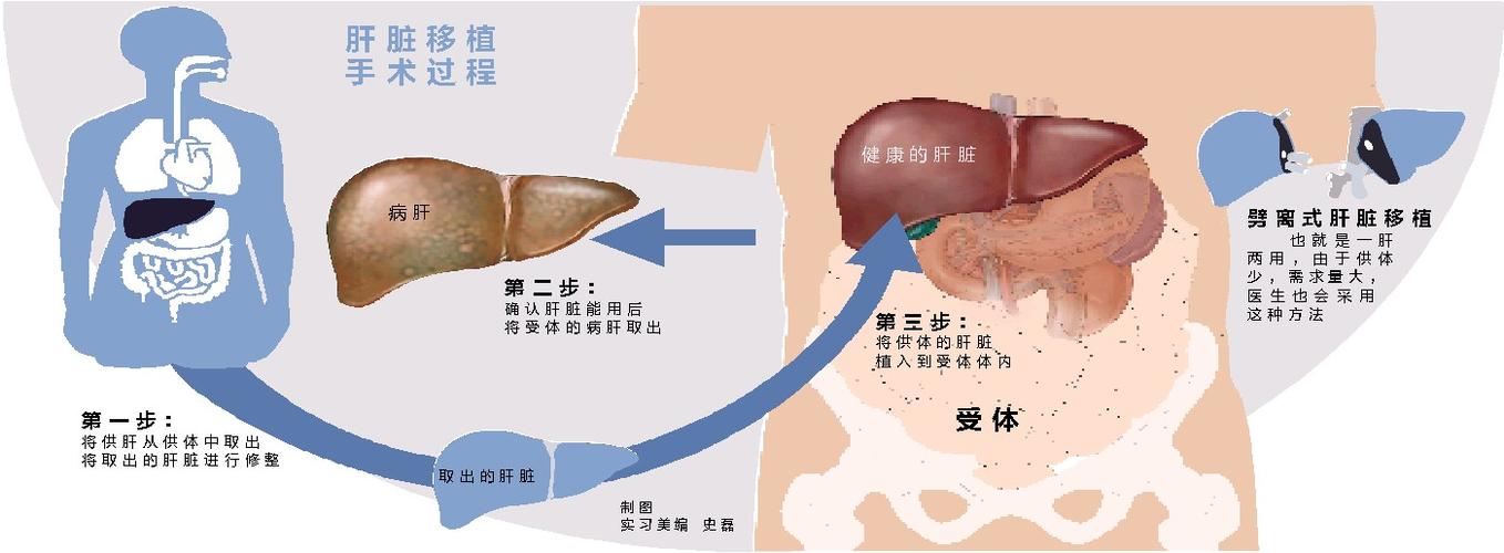 人的肉可移植吗？（人体哪些器官可以移植）