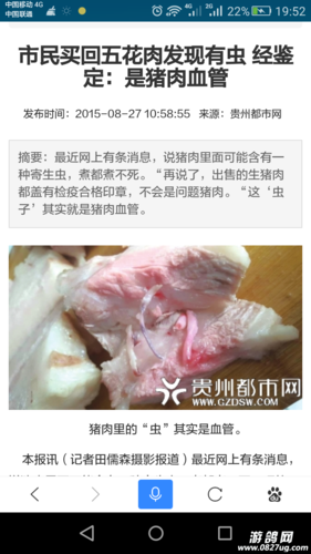 猪肉里会不会有寄生虫？（猪肉有哪些寄生虫）-图3