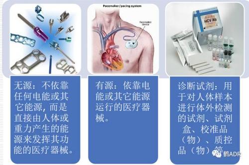 什么是有源医疗器械和无源医疗器械？（无源器械有哪些）